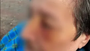 מנהלת המוסד שבו לפי החשד הותקפה קשישה: היו מקרים אלימים בעבר