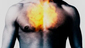 אש, בליבי בוערת אש: טיפול טבעי בצרבות