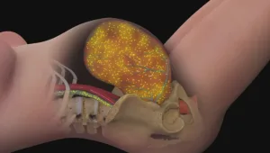 שינוי תפיסה: סיבוכים שהתגלו בהיריון - עלולים להשפיע גם בעתיד