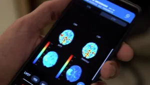 "לא צריך רופא": לקה באירוע מוחי - ופיתח תוכנה מצילת חיים