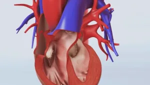 הפיתוח החדשני שמשפר את היכולת לטיפול בהפרעות קצב הלב