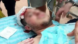 צעיר שהותקף על ידי בדואים בדרום: "לא דיברנו - והם חבטו בי"