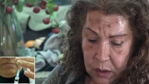 הזרקה ב־300 שקלים ופנים מצולקות לצמיתות: סכנת הבוטוקס המזויף