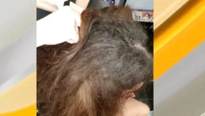 איך נראה שיערה של ילדה שלא הסתרקה 50 ימים בגלל הקורונה?