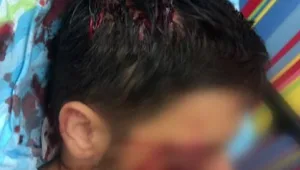 תלמיד תיכון אושפז לאחר שהותקף באכזריות באמצעות פטיש בביה"ס