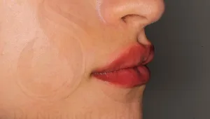 פלאח קליניק – ציפוי שיניים בלי לקרוע את הכיס