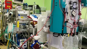 צעיר לא מחוסן חובר למכשיר האקמו האחרון באיכילוב: "בלתי נתפס"
