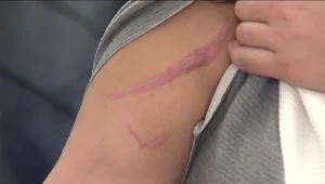 ליאנה כמעט נרצחה ע"י בעלה - ופרסמה את התמונות כאזהרה לנשים