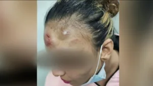 אל מול המצלמות: גבר תוקף את זוגתו באגרופים ובעיטות