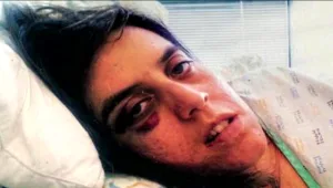 ליאת שרדה ניסיון רצח ע"י בן זוגה לשעבר - וחוששת משחרורו הקרב