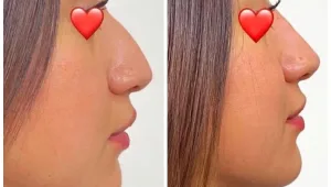 99% לקוחות חוזרים: הרשת לרפואה אסתטית שמעניקה אחריות מלאה על הטיפולים