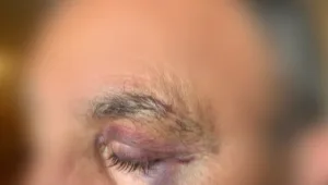 "פוצצו אותי ואיימו ברצח": עקף משאית בכביש - והוכה באכזריות