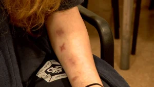 "לא ראו את הצלקות בזום": המחיר הנפשי שגבתה הקורונה מהנוער