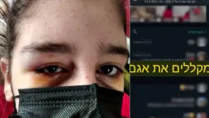 למרות התרעות האם: תלמידה חזרה מביה"ס עם פנס בעין וזעזוע מוח