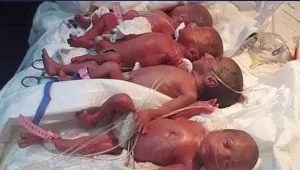 שיא עולמי: אישה באפריקה ילדה תשיעייה