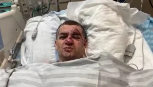 תושב אשקלון שביתו נפגע מרקטה: "מצאתי את עצמי על הרצפה"