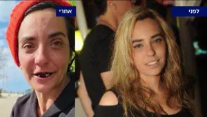 "לא בלי אחותי" נופר יוצאת לקרב על החיים של אחותה