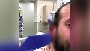 תיעוד: צעיר תוקף ונושך את אוזנו של אדם שניסה להרגיע אותו