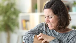 התקופה הזאת בשנה: 5 טיפים למניעת עקיצות ועוד כמה שתוכלו לדלג עליהם