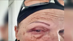 הרופאים התבלבלו בין המטופלים: הליך שגרתי הפך לסיוט