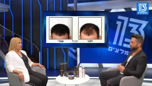 ריביירה שיער - הפתרון המושלם לשיער דליל