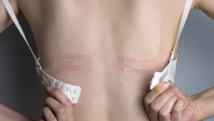 5 סימנים שהחזייה שלך צמודה מדי - ואיך תמצאי את הגודל המושלם בשבילך