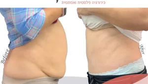 ד"ר מנאר קעואר - מומחה בכירורגיה פלסטית – בדרך  ליצירת יופי אנושי ולא "פלסטי"