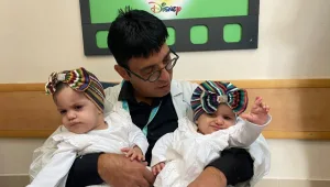 "מבצע שלא היה כמותו": התאומות שהיו מחוברות בראשן שוחררו