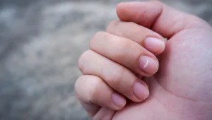 גם לכם יש את הכתם הלבן הזה על הציפורניים?