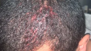 ניסיון לינץ' בבת ים: וידאו שמדובר בערבים - ותקפו אותם בסכינים ואגרופים