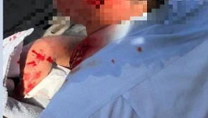 נהג אוטובוס בצפת נדקר באמצעות בקבוק בירה: "לעצור את הטרור"