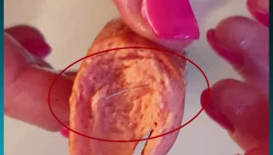 לאחר אזהרת זוגלובק - אם לבת 10 חושפת מקרה חמור