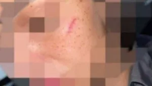 לוחמת מג"ב שהוכתה ע"י פלסטינית נחקרה וזומנה לשימוע: "אבסורד לחלוטין"