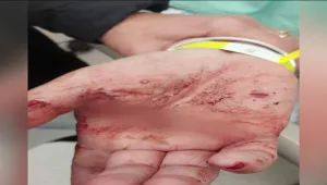 גנבים נכנסו בסנפלינג מהגג והכו את האמא במשך שעות