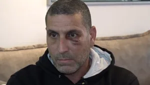 "חשבתי שהולכים להרוג אותי": נהג מונית הותקף - בגלל עקיפה