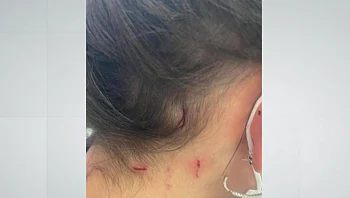 תקיפה באמצע היום ובלי סיבה: יצאה מחנות בת"א - והותקפה קשות ע"י דר רחוב
