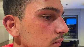 "בעטו לי בפנים": זעם על אלימות השוטרים כלפי אוהדי כדורגל אמש • תיעוד