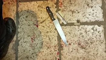 פיגוע דקירה בירושלים: שני שוטרים נפצעו קל-בינוני - המחבל חוסל