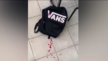 בזמן השיעור: תלמיד בן 14 נדקר מספר פעמים במספריים על ידי תלמיד אחר