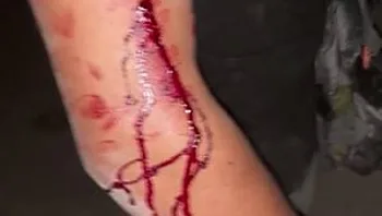 אחרי ששוחררו - הוארך מעצרם של שני חשודים בתקיפה בעכו