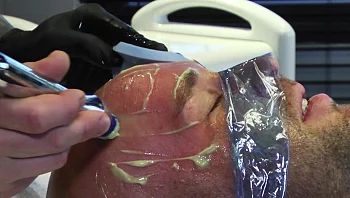 מטיפולי פנים ועד בוטוקס - הגברים של 2022