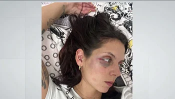 אימה בטיול: ולריה ומשפחתה טיילו בצפון והותקפו באלימות קשה