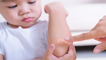 החופש הגדול מגיע ואיתו הסכנות: כך נתמודד עם הפציעות של ילדינו