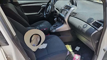 שיר לב שפניה הושחטו בפיגוע: "אם האבן הייתה ס"מ הצידה - לא הייתי פה"