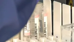 גילתה שאביה נשא גן סרטני: "יש עוד ילדים מתרומת הזרע הזו"