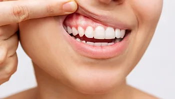 כך תדעו שיש לכם דלקת חניכיים – ואיך תתמודדו