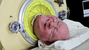 פול אלכסנדר, האיש שחי בתוך ריאת ברזל במשך 70 שנה, הלך לעולמו