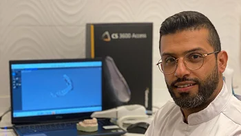 ציפוי שיניים מאמקס: המילה האחרונה בתחום חזיתות השיניים