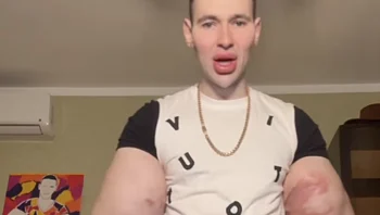 "פופאי הרוסי" אושפז לאחר שהזריק שמן כדי להגדיל את שריריו