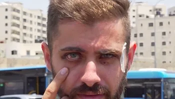 "התחיל לקלל ולתת סטירות": הנהג הערבי שהותקף בי-ם משחזר
